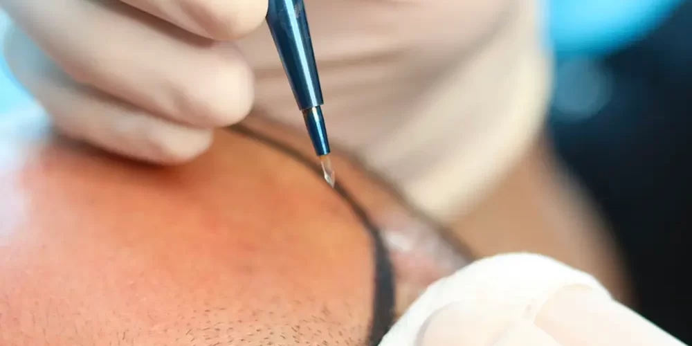 fue sapphire fue sapphire